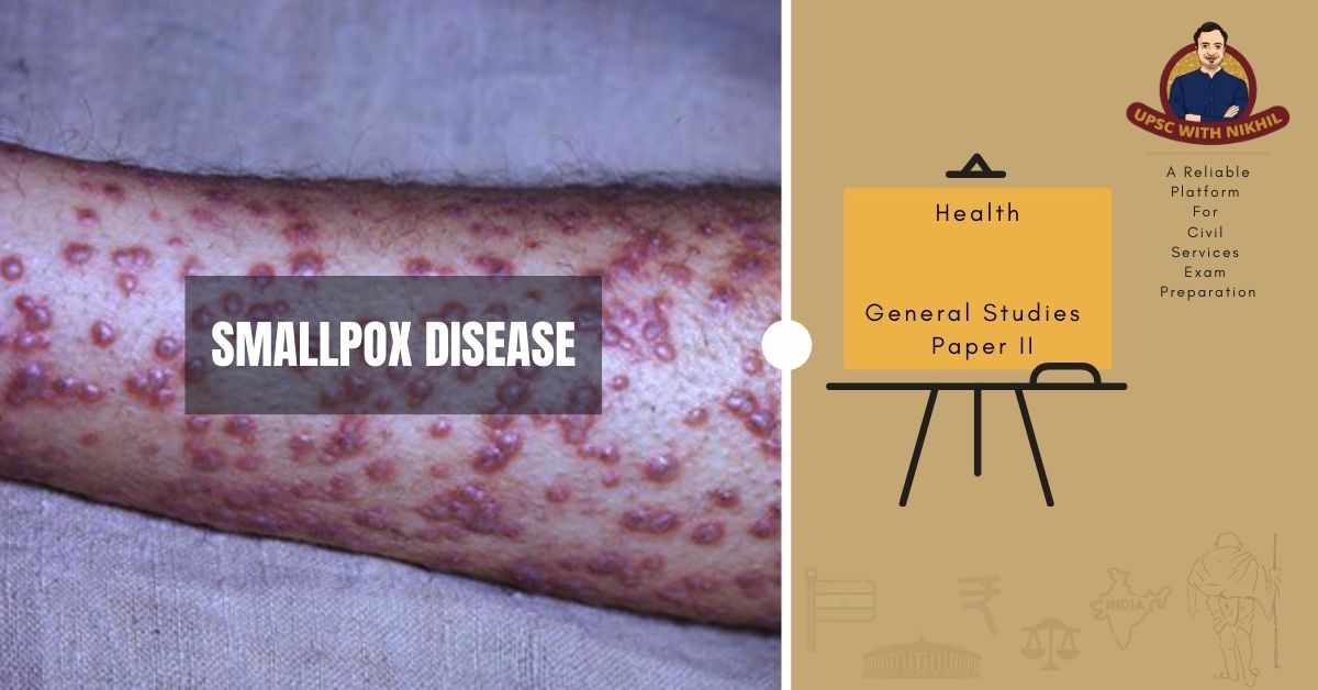 Smallpox