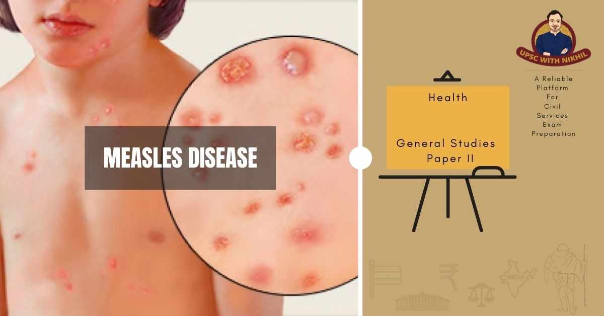 Measles